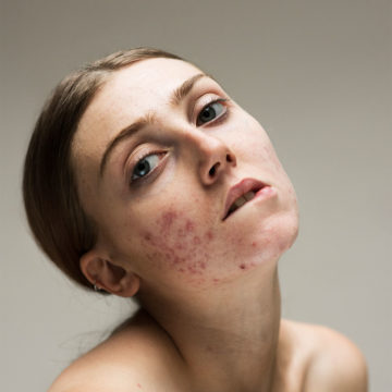 Model Louisa Northcote poses without makeup on
